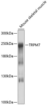 Western blot - TRPM7 Polyclonal Antibody 