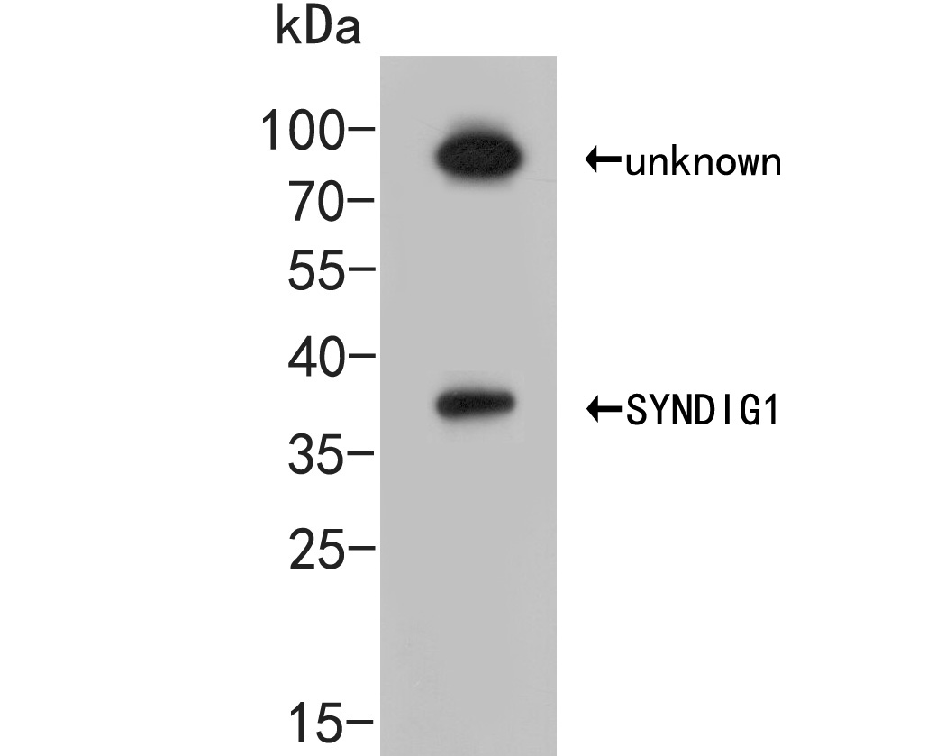Fig1:; Western blot analysis of SYNDIG1 on 293 cell lysate. Proteins were transferred to a PVDF membrane and blocked with 5% BSA in PBS for 1 hour at room temperature. The primary antibody ( 1/500) was used in 5% BSA at room temperature for 2 hours. Goat Anti-Rabbit IgG - HRP Secondary Antibody (HA1001) at 1:5,000 dilution was used for 1 hour at room temperature.
