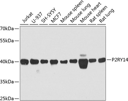 Western blot - P2RY14 Polyclonal Antibody 