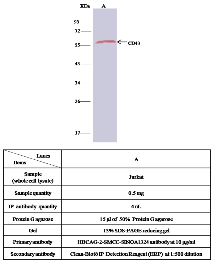 Human SPN/CD43 Immunoprecipitation(IP) 14617