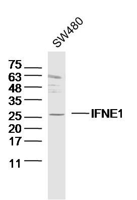 Fig1: Sample: SW480 (human)cell Lysate at 40 ug; Primary: Anti- IFNE1 at 1/300 dilution; Secondary: IRDye800CW Goat Anti-Rabbit IgG at 1/20000 dilution; Predicted band size: 22kD; Observed band size: 25 kD