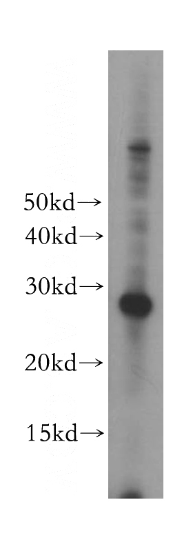 Jurkat cells were subjected to SDS PAGE followed by western blot with Catalog No:113423(ORC6L antibody) at dilution of 1:800