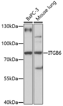 Western blot - ITGB6 Polyclonal Antibody 