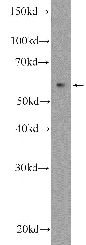 HepG2 cells were subjected to SDS PAGE followed by western blot with Catalog No:114765(RNFT2 Antibody) at dilution of 1:300