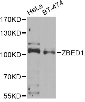 Western blot - ZBED1 Polyclonal Antibody 