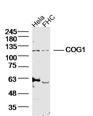 Fig2: Sample:; Hela Cell (Human) Lysate at 40 ug; FHC Cell (Human) Lysate at 40 ug; Primary: Anti-COG1 at 1/300 dilution; Secondary: IRDye800CW Goat Anti-Rabbit IgG at 1/20000 dilution; Predicted band size: 109 kD; Observed band size: 109 kD