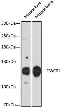 Western blot - CWC22 Polyclonal Antibody 