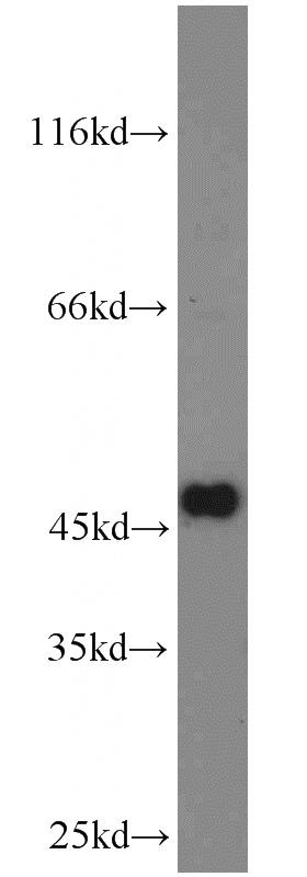 NIH/3T3 cells were subjected to SDS PAGE followed by western blot with Catalog No:108323(ATPBD4 antibody) at dilution of 1:1000