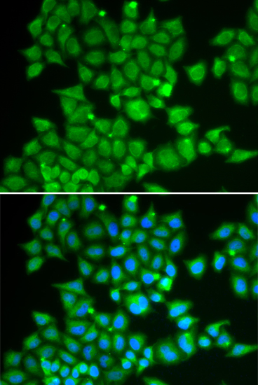 Immunofluorescence - PDE1B Polyclonal Antibody 
