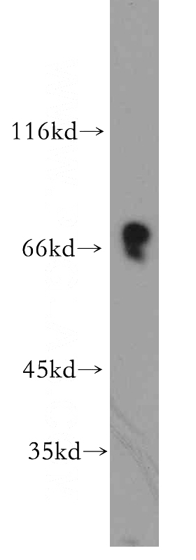 A549 cells were subjected to SDS PAGE followed by western blot with Catalog No:112259(KCND2 antibody) at dilution of 1:300
