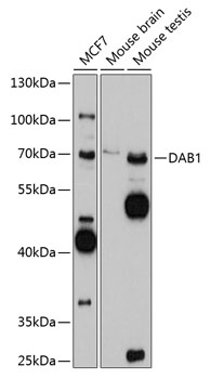 Western blot - DAB1 Polyclonal Antibody 