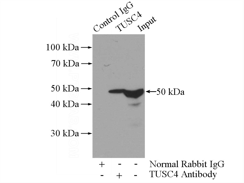 IP Result of anti-NPR2L,TUSC4 (IP:Catalog No:116496, 3ug; Detection:Catalog No:116496 1:500) with mouse pancreas tissue lysate 4000ug.