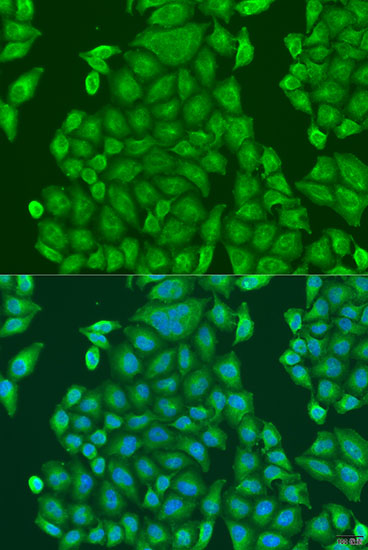 Immunofluorescence - CENPK Polyclonal Antibody 