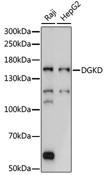 Western blot - DGKD Polyclonal Antibody 
