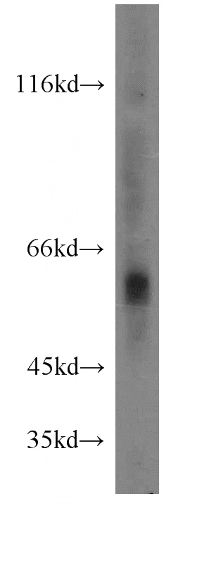Sp2/0 cells were subjected to SDS PAGE followed by western blot with Catalog No:108886(CTSA antibody) at dilution of 1:300