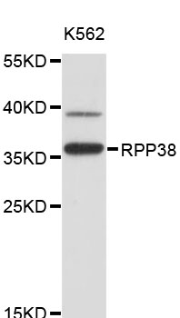 Western blot - RPP38 Polyclonal Antibody 
