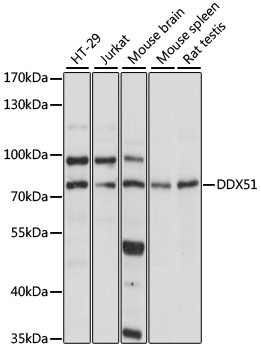 Western blot - DDX51 Polyclonal Antibody 