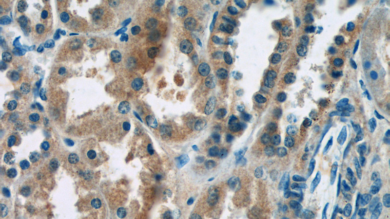 Immunohistochemistry of paraffin-embedded human kidney tissue slide using Catalog No:110058(domain-I-of-FIZ-1 Antibody) at dilution of 1:50 (under 40x lens)