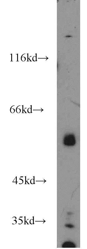 HeLa cells were subjected to SDS PAGE followed by western blot with Catalog No:113431(OSBPL2 antibody) at dilution of 1:1000