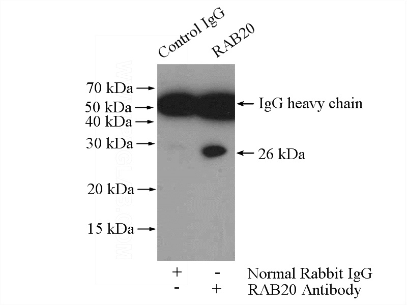 IP Result of anti-RAB20 (IP:Catalog No:114419, 4ug; Detection:Catalog No:114419 1:1000) with SW 1990 cells lysate 2400ug.