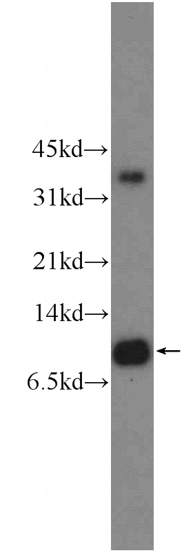 HeLa cells were subjected to SDS PAGE followed by western blot with Catalog No:112352(LSM8 Antibody) at dilution of 1:300