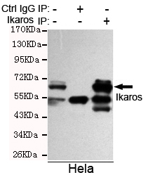 Immunoprecipitation analysis of Hela cell lysate using Ikaros (C-terminus) mouse mAb.