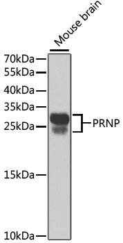 Western blot - PRNP Polyclonal Antibody 