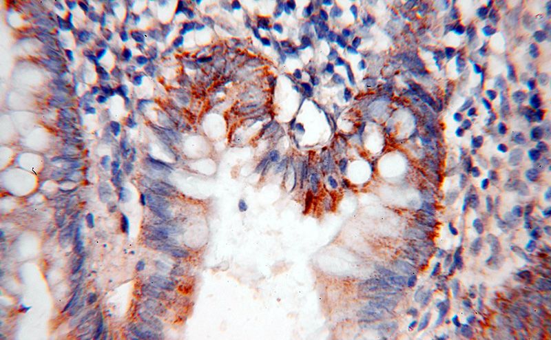 Immunohistochemical of paraffin-embedded human colon using Catalog No:109004(CCL28 antibody) at dilution of 1:50 (under 40x lens)