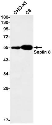 Western blot detection of Septin 8 in CHO-K1,C6 cell lysates using Septin 8 Rabbit mAb(1:1000 diluted).Predicted band size:56kDa.Observed band size:56kDa.