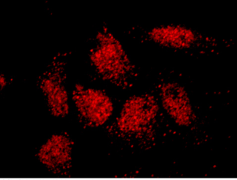 Human ISL2 / Islet 2 Immunofluorescence(IF) 15194