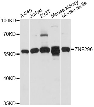 Western blot - ZNF296 Polyclonal Antibody 