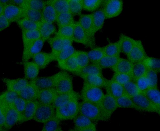 Fig3: ICC staining GPX5 (green) in 293T cells. The nuclear counter stain is DAPI (blue). Cells were fixed in paraformaldehyde, permeabilised with 0.25% Triton X100/PBS.
