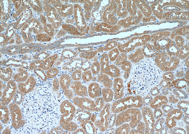Immunohistochemistry of paraffin-embedded human kidney tissue slide using Catalog No:108653(C13orf30 Antibody) at dilution of 1:200 (under 10x lens).