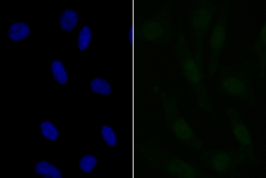 Fig3: ICC staining APR3 in SH-SY-5Y cells (green). The nuclear counter stain is DAPI (blue). Cells were fixed in paraformaldehyde, permeabilised with 0.25% Triton X100/PBS.