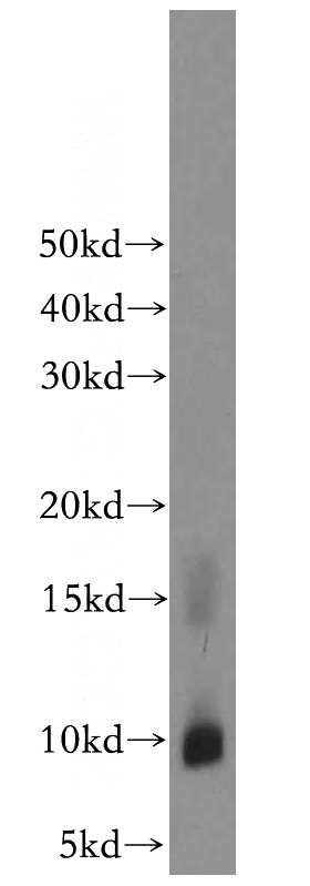 SH-SY5Y cells were subjected to SDS PAGE followed by western blot with Catalog No:108864(CARTPT antibody) at dilution of 1:800