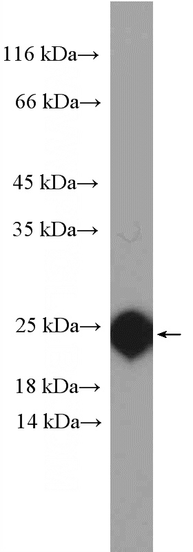 human plasma tissue were subjected to SDS PAGE followed by western blot with Catalog No:114562(RBP4 Antibody) at dilution of 1:1000