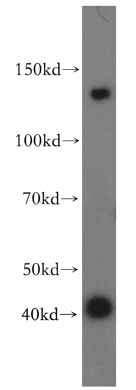mouse lung tissue were subjected to SDS PAGE followed by western blot with Catalog No:109344(CLCA2 antibody) at dilution of 1:300