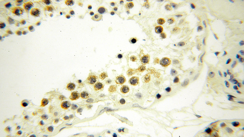 Immunohistochemical of paraffin-embedded human testis using Catalog No:108535(BTBD1 antibody) at dilution of 1:100 (under 40x lens)