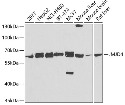 Western blot - JMJD4 Polyclonal Antibody 