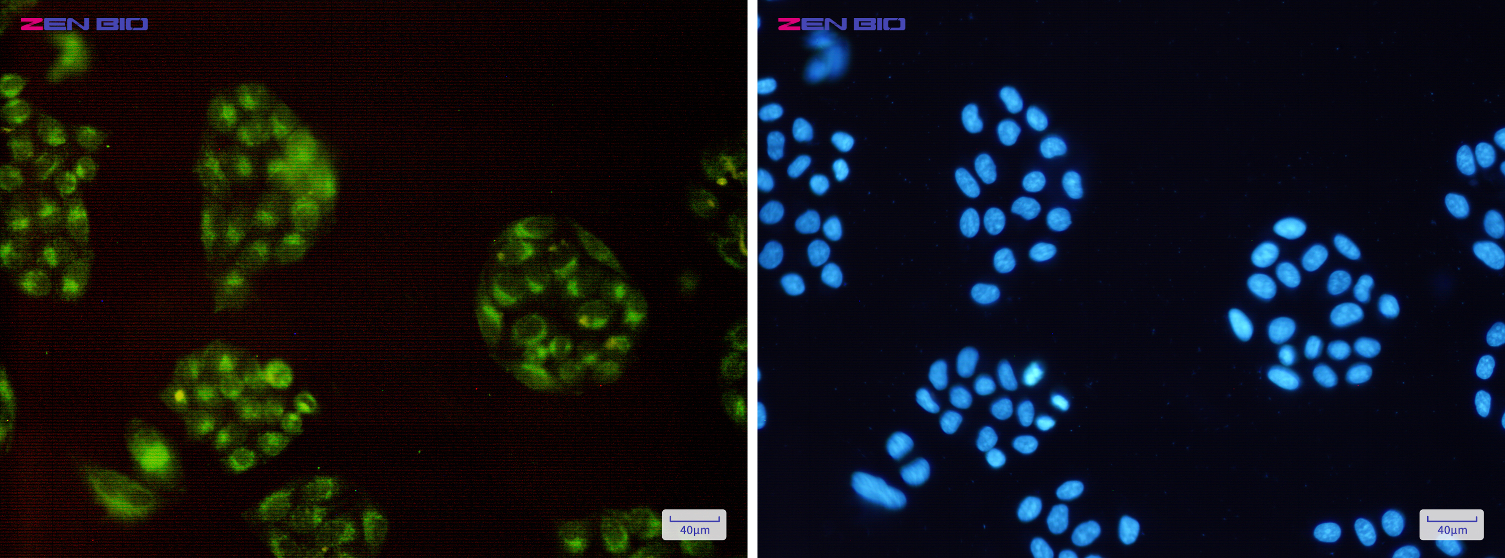 Immunocytochemistry of ATP6V0D1(green) in Hela cells using ATP6V0D1 Rabbit pAb at dilution 1/50, and DAPI(blue)