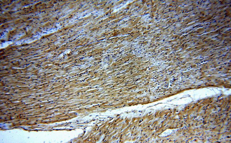 Immunohistochemical of paraffin-embedded human heart using Catalog No:113214(NPHP4 antibody) at dilution of 1:50 (under 10x lens)