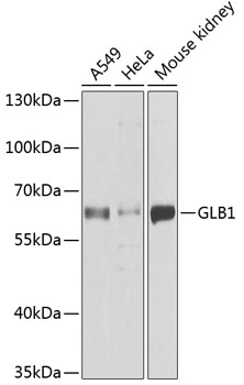 Western blot - GLB1 Polyclonal Antibody 