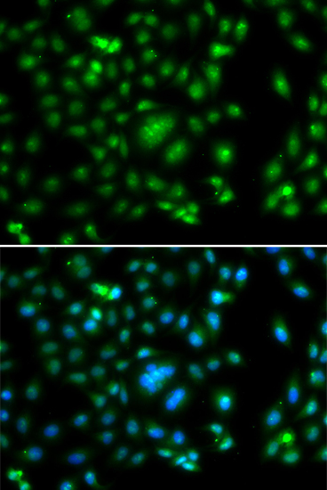 Immunofluorescence - ELF5 Polyclonal Antibody 