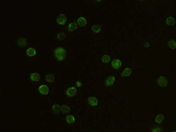 CD132 / IL2RG Antibody, Rabbit MAb, Immunofluorescence