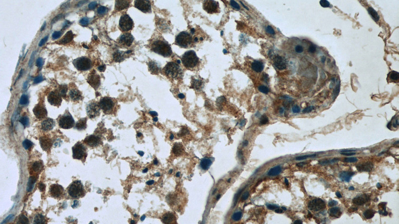 Immunohistochemistry of paraffin-embedded human testis tissue slide using Catalog No:115539(SPANXA2 Antibody) at dilution of 1:50