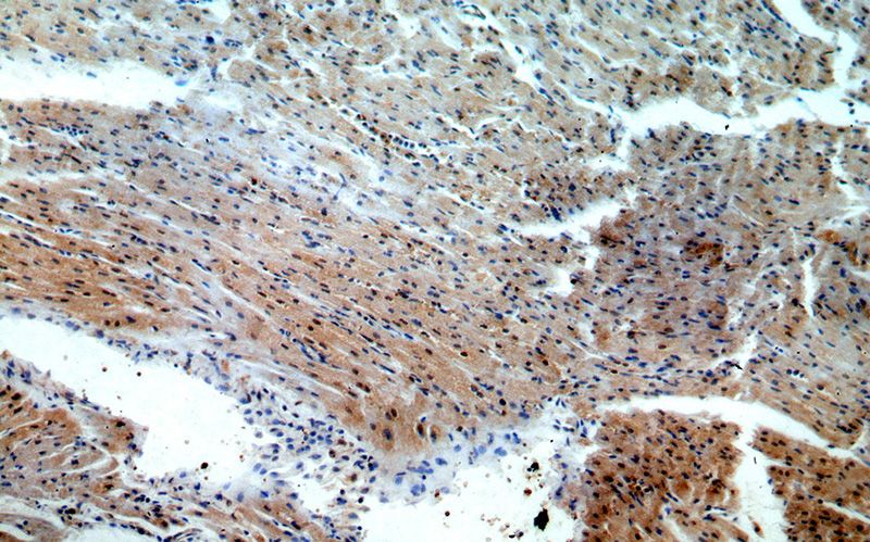 Immunohistochemical of paraffin-embedded human heart using Catalog No:116428(TSG101 antibody) at dilution of 1:50 (under 10x lens)