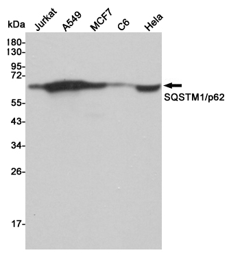 Western blot analysis of extracts from Jurkat,A549,MCF7,C6 and Hela cell lysates using SQSTM1/p62 mouse mAb (1:1000 diluted).Predicted band size:62KDa.Observed band size:62KDa.