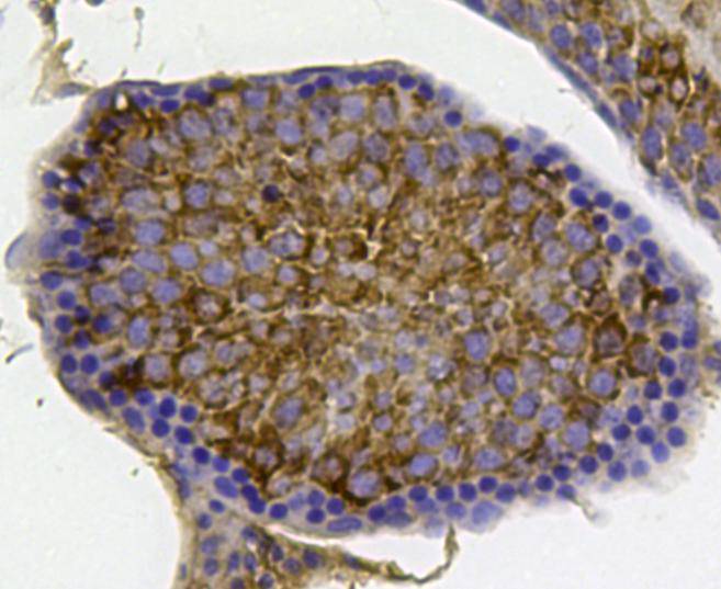 Fig3: Immunohistochemical analysis of paraffin- embedded mouse testis tissue using anti-YB1 rabbit polyclonal antibody.