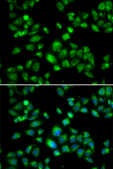 Immunofluorescence - MBTPS1 Polyclonal Antibody 