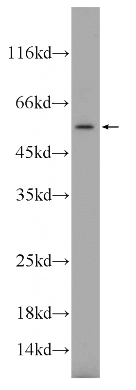 HL-60 cells were subjected to SDS PAGE followed by western blot with Catalog No:116357(TREML4 Antibody) at dilution of 1:500